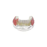 Modelo de Dientes de Mandíbula Inferior Removible con Implante, Restauración de Puente, Modelo de Implante Dental para Educación, Enseñanza, Estudio y Práctica