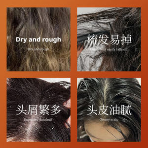 Shampoo de Ervas Polygonum multiflorum, Sabonete Herbal Natural, Loja Oficial - Product Image 4