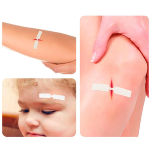 Pansements adhésifs papillon hypoallergéniques stériles, lot assorti de 10, avec fermeture anti-adhésive pour plaies, sans latex - Product Image 4