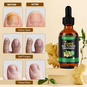 SEFUDUN Sérum Liquide de Croissance au Gingembre pour Mycose des Ongles 7 Jours, Service OEM, Répare les Ongles Cassants, Nourrit les Cuticules, Vente en Gros Disponible - Product Image 1