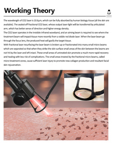 Portable High <b>Strength</b> CO2 Laser for Acne <b>Scars</b> Skin Resurfacing Machine 10600nm Commercial Use - Product Image 4