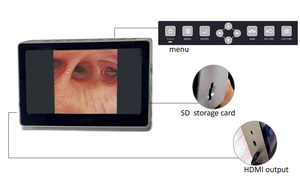 Équipement médical, endoscope flexible ORL, endoscope vétérinaire, vidéo-bronchoscope haute définition, nasopharyngoscope - Product Image 6