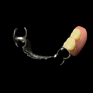 Prothèse avancée d'alliage de chrome de cobalt avec la technologie de moulage de précision - Product Image 3