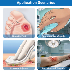 Sistem Terapi Luka Tekanan Negatif BLUENJOY, Perban <span class=keywords><strong>VAC</strong></span> Luka, Perlengkapan Perban NPWT, Terapi Rehabilitasi - Product Image 4