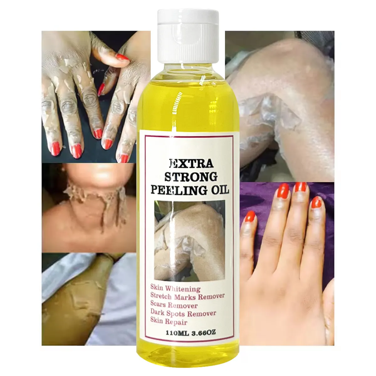 Huile de gommage jaune extra forte anti-taches de marque privée blanchissante forte pour éliminer les peaux mortes exfoliante pour les jointures foncées