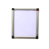 Boîte de visualisation médicale, négascope médical à LED, luminosité réglable, double panneau, visionneuse de films radiologiques médicaux, négascope
