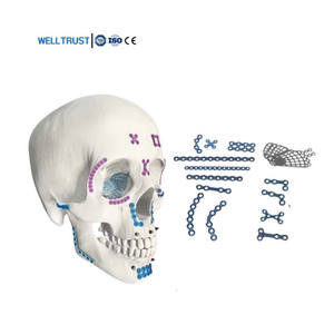 Piastra maxillo-facciale in titanio con impianti chirurgici ortopedici medici di alta qualità - Product Image 6
