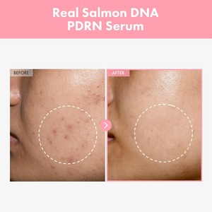 Marca Privada de Cuidado de la Piel PDRN para Suero con Péptidos, Niacinamida, Hidratante, Reafirmante, Blanqueador, Acabado Radiante, Vitamina <span class=keywords><strong>C</strong></span>, Coreano - Product Image 2