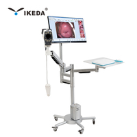 YKD-3003 HD Digital Kolposkop Kamera Heiße Vagina Bilder Nicht-aktives chirurgisches Instrument