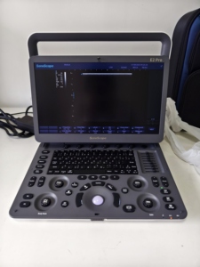 Máquina de Ecografía Doppler a Color SonoScape E2pro, Ecógrafo Portátil E2, Ultrasonido Portátil - Product Image 2