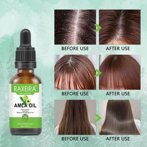 Aceite de Amla Natural de Marca Privada, Aceite para el Crecimiento del Cabello, Fortalecedor, Nutritivo, Suavizante, Aceites para el Cuidado del Cabello para Productos de Crecimiento Capilar - Product Image 5