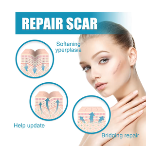 Gel para Cicatrices Advance con Logotipo Personalizado, Eliminación de Cicatrices de 20g, Quemaduras, Heridas Quirúrgicas, Eliminación de Estrías, Gel Removedor de Cicatrices - Product Image 5