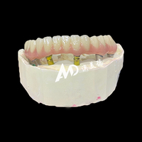 Prothèse dentaire implantée avec piliers en titane et couronne en zircone, fabrication sur mesure CAD/CAM pour cliniques et laboratoires dentaires