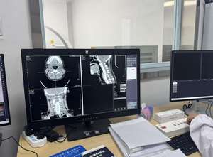 Monitor CCTV LCD de 24 Pulgadas Full HD con Entrada VGA, AV, BNC y USB, Montaje en Pared, Monitor TFT CCTV para Uso Médico Veterinario - Product Image 2