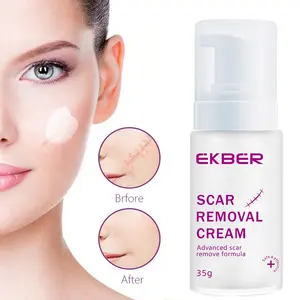 Creme De Remoção De Cicatriz De Baixo Moq Para Cicatrizes Velhas No Rosto Creme De Remoção De Cicatriz De Acne Forte Eficaz