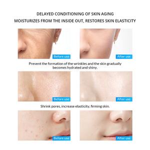 Nouveau Sérum de soin de la peau Sérum <span class=keywords><strong>pour</strong></span> le visage Essence d'acide hyaluronique de haute qualité <span class=keywords><strong>pour</strong></span> l'élimination des cicatrices d'acné et anti-âge - Product Image 4