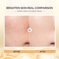 Sérum Visage Liquide Anti-Âge Végétalien Marque Blanche OEM Acide Hyaluronique Vitamines C 15%/20%/30% Glycérine Or 24K pour Éclaircissement