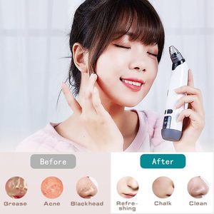 Điện có thể điều chỉnh sưởi ấm mụn đầu đen Remover USB có thể sạc lại mụn đầu đen Remover Công cụ cho khuôn mặt - Product Image 2