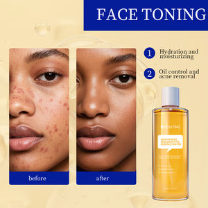 Tónico Facial Reductor de Poros, Reafirmante de la Piel, Suavizante, Iluminador, Hidratante, con Arbutina y Niacinamida, Blanqueador - Product Image 2