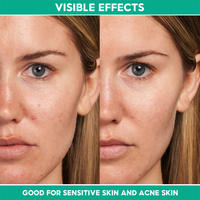 Fabricants en gros de soins de la peau végétaliens réparateurs calmants Centella Asiatica crème hydratante pour le visage lotion hydratante pour le visage