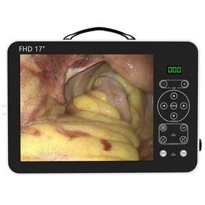 Caméra <span class=keywords><strong>endoscopique</strong></span> médicale portable Full HD, unité de caméra laparoscopique, ensemble d'hystéroscope, caméra laparoscopique portable 4K - Product Image 2