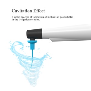 Vente flash Équipement dentaire Activateur <span class=keywords><strong>endo</strong></span> RW-3 Irrigateur de canal radiculaire Irrigateur <span class=keywords><strong>endo</strong></span> pour traitement dentaire avec 60 embouts - Product Image 4