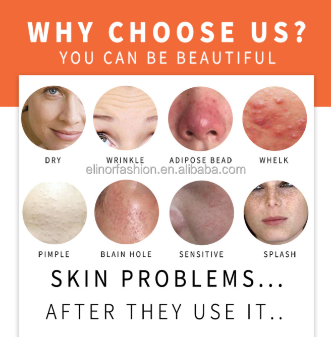 buy whitening body soap,bleaching soap whitening,skin