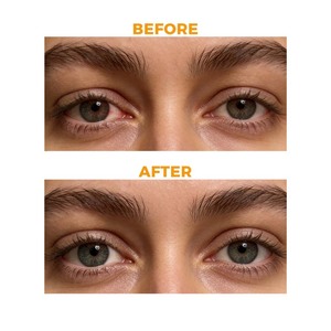 Spray pour les yeux HODAF à la lutéine pour le soin des yeux - Spray hydratant et rafraîchissant quotidien - Product Image 5