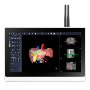 La carcasa de aluminio blanca es estéticamente agradable y permite conectar un monitor de alta definición a la unidad principal. P - Product Image 4