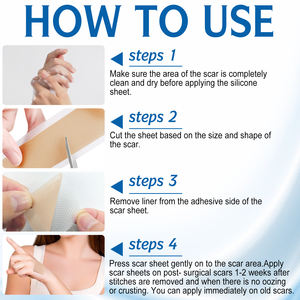 ALIVER 1.8X120 ''rouleau peau réparatrice brûlure chirurgicale cicatrice patchs Silicone cicatrice Gel feuilles d'enlèvement - Product Image 6
