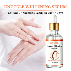 Sérum éclaircissant pour les jointures sous marque privée 50ml, éliminateur de taches brunes pour coudes et <span class=keywords><strong>genoux</strong></span>, sérum éclaircissant pour les mains, en stock, livraison rapide - Product Image 6