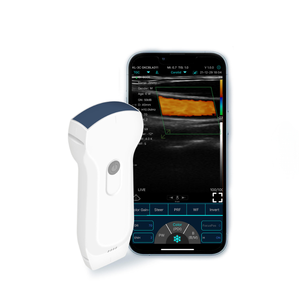 Vente directe d'usine, sonde d'échographie vétérinaire portable multifonctionnelle, utilisation animale, échographie de la tête, sans fil, VENTE CHAUDE - Product Image 5
