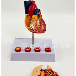Modèle de cœur humain, modèle de cœur agrandi, modèle d'infarctus, modèle anatomique du cœur. - Product Image 3