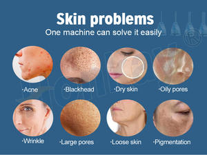 Appareil de peeling à jet d'oxygène 8 en 1 pour l'élimination des points noirs et l'hydratation intense pour une utilisation en salon de beauté - Product Image 4