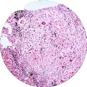 ウサギの舌 (味のつぼみを表示) sec. prepared顕微鏡スライド組織学スライド - Product Image 1