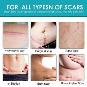 Patch cicatrisant pour l'acné, les vergetures et les cicatrices, soin éclaircissant et lissant pour la peau, contre les imperfections du visage et l'acné infantile, pour la pigmentation - Product Image 6