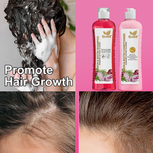 Tùy Chỉnh Thuần Chay Hành Tây Biotin Tăng Trưởng Tóc Kit Sulphate-Miễn Phí Dầu Gội Đầu Và Điều Hòa Với Màu Đỏ Hành Tây Dầu Cho Tóc Tăng Trưởng Nhanh - Product Image 6