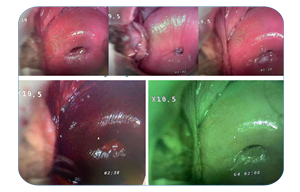 Fabrik preis 1080P Full HD Binokular Kolpos kopie Gynäkologie Gebärmutter hals krebs Screening Diagnose geräte mit 1 Jahr Garantie - Product Image 2