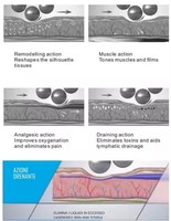 Appareil de remodelage corporel à rouleaux à billes interne, machine de massage à rouleaux sous vide pour drainage lymphatique et soins amincissants du corps
