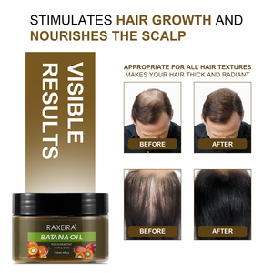 Private Label Batana crescita dei <span class=keywords><strong>capelli</strong></span> prodotti olio <span class=keywords><strong>balsamo</strong></span> Anti perdita di <span class=keywords><strong>capelli</strong></span> riparazione Batana olio per la crescita dei <span class=keywords><strong>capelli</strong></span> olio essenziale - Product Image 4