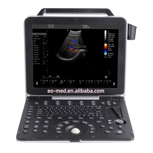 Appareil d'échographie cardiaque EO-C50, scanner d'échographie Doppler couleur portable, appareil de diagnostic ultrasonore avec batterie intégrée - Product Image 1