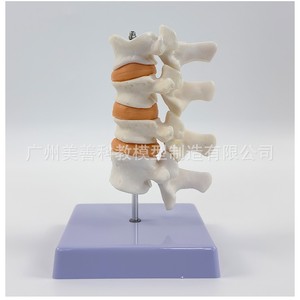 Simulation pédagogique de l'ostéoporose humaine, de la colonne vertébrale, des vertèbres lombaires, du squelette, de la structure osseuse, de la pathologie, des intervertèbres lombaires - Product Image 4