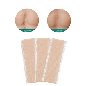 SAMVO Folha de Gel de Silicone Médico para Cicatrizes, Impermeável, Hipoalergênica, Cor NUDE, Adesivo de Tratamento para Cicatrizes e Estrias, Suprimento de Saúde - Product Image 5