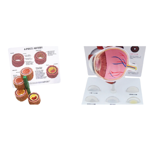 ADA <b>Medical</b> Science 4-Piece Artery Disease <b>Model</b> and Cataract <b>Model</b> Disease Demonstration <b>Medical</b> Teaching Tool - Product Image 1