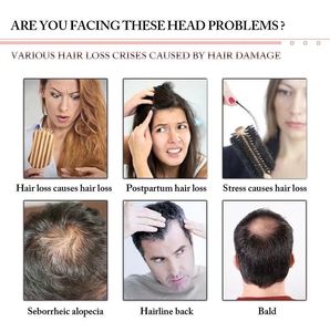 Hot Sale 5in1 High Frequency Wand Hair Growth Head Massage Hair Follicles Scalp Analysis Scanner Hair Analyzer <b>Machine</b> - Product Image 5