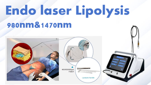 360 Lipo Lab Fat Dissolving Injections Laser Endoskin Endolaser 980nm 1470nm Liposuccion <span class=keywords><strong>Lipolyse</strong></span> <span class=keywords><strong>Double</strong></span> Chin Removal Device - Product Image 2