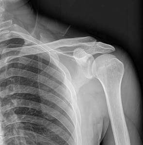 17*17 pouces Gos filaire numérique X Ray détecteur de défauts à écran plat équipement de radiologie et accessoire pour machine à rayons X humaine - Product Image 5