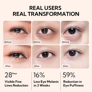 LANBENA Esencia para Ojos para Hombres y Mujeres, Antiarrugas, Elimina Ojeras, Atenua Líneas Finas, Reafirmante, para un Aspecto Vibrante y Glamuroso - Product Image 6
