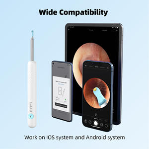 Bebird WLAN-fähiger Ohrenschmalzentferner Visueller Ohrenreiniger mit Kamera und Ohrlöffeln für Mobiltelefone - Product Image 2