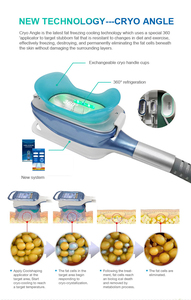 เครื่องมือความงาม 360 Cryoo กำจัดไขมันด้วยความเย็น Cryolipolysis เครื่องลดสัดส่วนสำหรับร้านเสริมสวย - Product Image 4